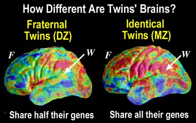 brain diversity