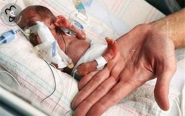 newborn premature pic