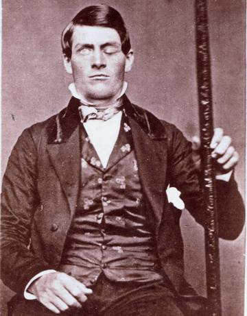 [ Miswired Phineas Gage 20181005 pic ]