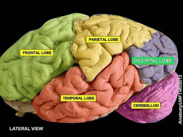[ lateral brain pic ]