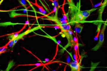 neurons and astrocytes picture